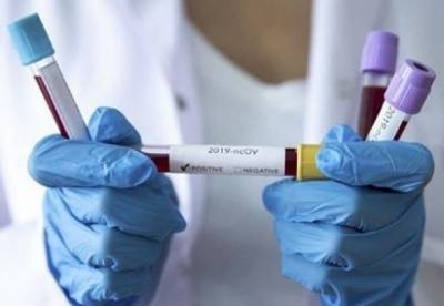 Максим Степанов - В Украине выявили 4 385 новых случаев коронавируса. Это минимум с начала октября - facenews.ua - Украина - Киев