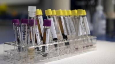 Ученые заявили о влиянии генетики на риск смерти от коронавируса - inforeactor.ru