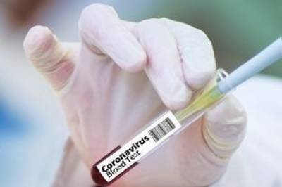 Великобритания стала первой в мире страной, одобрившей вакцину от компании AstraZeneca - newsone.ua - Украина - Англия