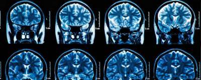 Ученые из США считают, что вирус может нарушать работу мозга - runews24.ru - Сша