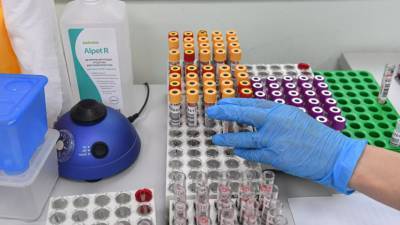 Украина получила партию южнокорейских тестов на антиген коронавируса - russian.rt.com - Украина - Китай - Киев