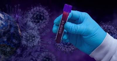 Верховная Рада упростила регистрацию вакцин от коронавируса в Украине - focus.ua - Украина