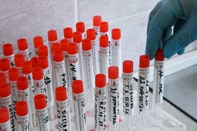 265 случаев заражения коронавирусом выявлено в Забайкалье за сутки, всего – 20,8 тыс. - chita.ru - Россия - Забайкальский край