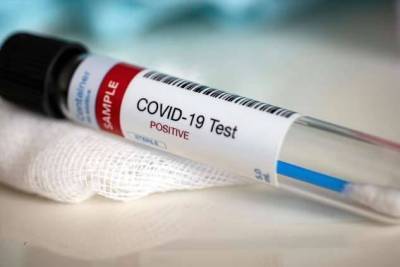 Положено ли лечение от коронавируса бесплатно? И другие виды бесплатной медицинской помощи, о которых вы должны знать - skuke.net - Россия