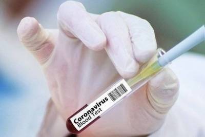 Александр Мясников - Доктор Мясников рассказал, чем отличаются тесты на коронавирус - versia.ru