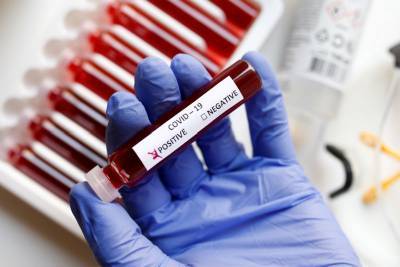 В Ленобласти выявили 215 новых зараженных коронавирусом 6 декабря - ivbg.ru - Россия - Санкт-Петербург - Ленобласть обл.
