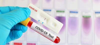"Клиники на Чайкиной": Узнайте, есть ли у вас коронавирус COVID-19 всего за 30 минут - stolicaonego.ru