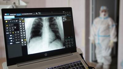 В Петербурге предложили метод "расширения лёгких" для лечения COVID-19 - dp.ru - Санкт-Петербург