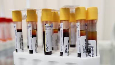Более 80 млн тестов на коронавирус проведено в России - russian.rt.com - Россия