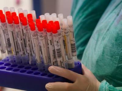 Словакия снизила на 60% заболеваемость COVID-19 с помощью массового тестирования - unn.com.ua - Киев - Словакия