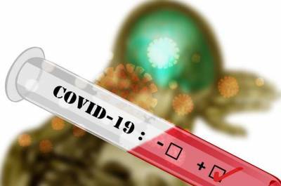 Ринат Максютов - Центр «Вектор» создал экспресс-тест на антитела к COVID-19, выдающий результат через 18 минут - actualnews.org