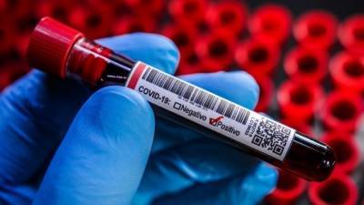 Какая связь между группой крови и смертностью от коронавируса? - 5-tv.ru - Сша - Китай - Иран