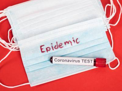 В Украине минимальное за шесть дней число новых случаев коронавируса. За сутки умерло 10 человек - gordonua.com - Украина