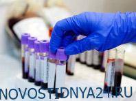 Новые мощные антитела против коронавируса удивили исследователей - novostidnya24.ru - Амстердам