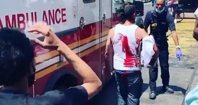 На вирусном видео мужчина ходил с ножом в голове после нападения грабителей в Нью-Йорке - usa.one - Нью-Йорк - Нью-Йорк