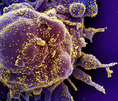 Ученые обнаружили «зловещие» щупальцы у вируса SARS-CoV-2 - znak.com - Сан-Франциско