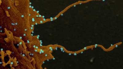 Неван Кроган - Американские ученые обнаружили у коронавируса "зловещие щупальца" - newizv.ru - Сша