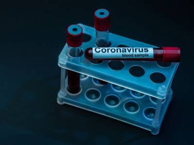 Количество новых случаев коронавируса в Украине существенно снизилось – до минимума с 9 июня - gordonua.com - Украина