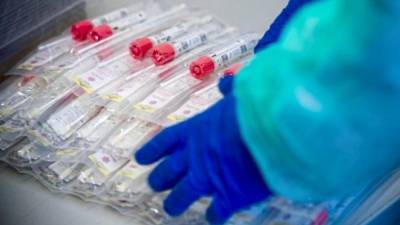 В Баварии бесплатный тест на коронавирус теперь сможет сдать каждый, даже не имя симптомов болезни - germania.one