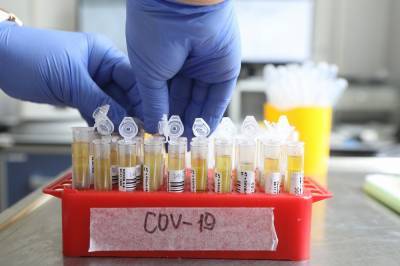 Более 19,5 миллиона тестов на коронавирус проведено в России - vm.ru - Россия