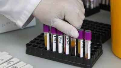 В России за сутки зафиксировано 6537 новых случаев коронавируса - russian.rt.com - Россия
