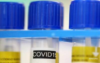 В Австрии в продаже появились "домашние" ПЦР-тесты на коронавирус - korrespondent.net - Австрия