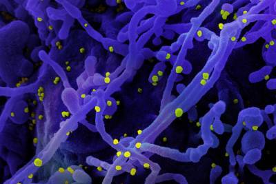 Опасное антитело обнаружено у больных с тяжелой формой COVID-19 - vm.ru - Голландия - Амстердам - Amsterdam