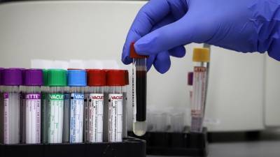 В России провели свыше 24 млн тестов на коронавирус - russian.rt.com - Россия