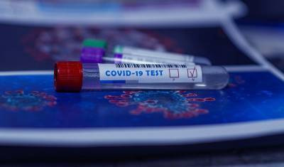 В России сделали свыше 24,3 миллионов тестов на коронавирус - nashgorod.ru - Россия