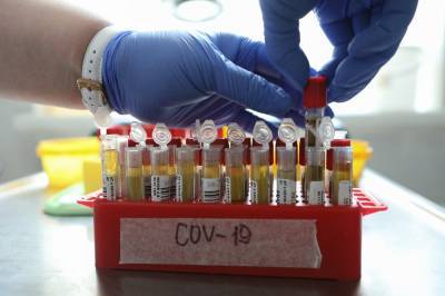 Более 25 миллионов тестов на коронавирус проведено в России - vm.ru - Россия