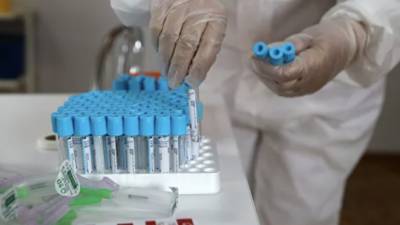 Число случаев коронавируса в Узбекистане достигло 16 966 - russian.rt.com - Узбекистан
