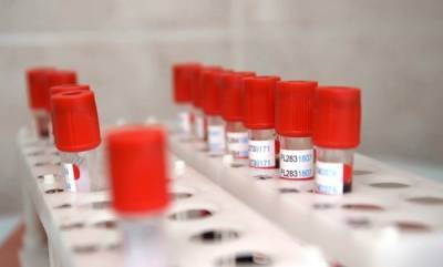 Число проведённых в России тестов на коронавирус превысило 26 млн - govoritmoskva.ru - Россия
