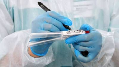Учёные в США разработали «моментально» выявляющий коронавирус прибор - russian.rt.com - Сша - Вашингтон - Колумбия