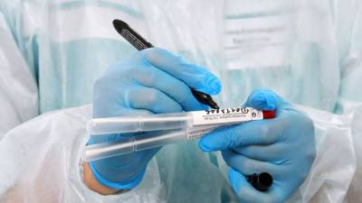 Более 27,8 млн тестов на коронавирус проведено в России - russian.rt.com - Россия