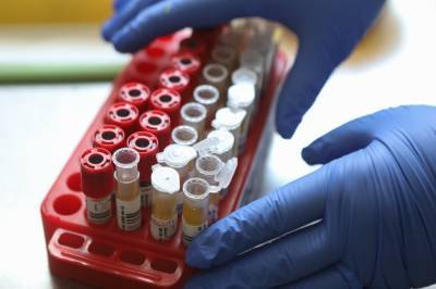 Число проведенных в России тестов на коронавирус превысило 28 миллионов - vm.ru - Россия