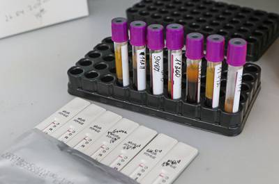 Россия передала тест-системы и реагенты для исследований на коронавирус в странах Центральной Америки - pnp.ru - Россия - Сан-Хосе - Коста Рика