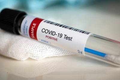 Ученые нашли мутации, которые повышают риск гибели от COVID-19 - vm.ru