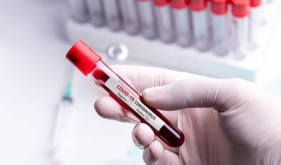В Испании разработали тест с точностью 98% на антитела к коронавирусу - newizv.ru - Испания - Мадрид
