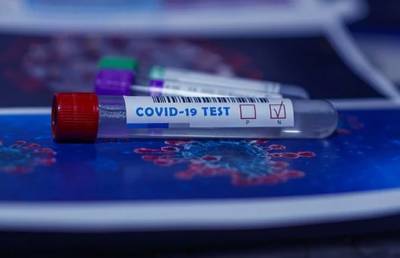 Минздрав сообщил, где в Минске проводится платное экспресс-тестирование на антитела к COVID-19 - ont.by - Белоруссия - Минск