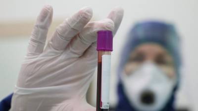 Алексей Аграновский - Более 30,8 млн тестов на коронавирус проведено в России - russian.rt.com - Россия