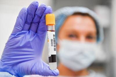 В России с начала пандемии провели более 33 млн тестов на коронавирус - pnp.ru - Россия