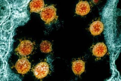 Назван способствующий распространению коронавируса климат - lenta.ru - Сша - штат Миссури