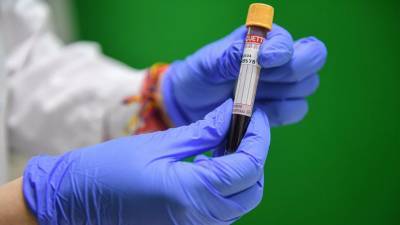 Более 33,8 млн тестов на коронавирус проведено в России - russian.rt.com - Россия