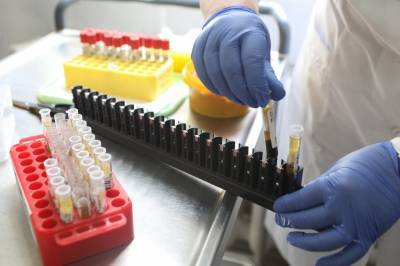 Число проведенных в России тестов на коронавирус превысило 34 миллиона - vm.ru - Россия