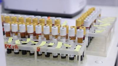 На Украине за сутки выявили 2328 случаев коронавируса - russian.rt.com - Украина