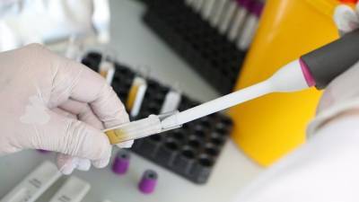 Более 34,8 млн тестов на коронавирус проведено в России - russian.rt.com - Россия