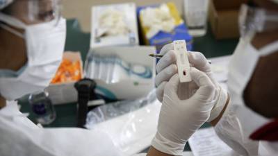 Эксперты обеспокоены изменением рекомендаций CDC по тестированию на коронавирус - golos-ameriki.ru - Сша