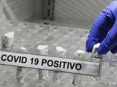 В США подтвердили первый случай повторного заражения COVID-19. Второе инфицирование пациент перенес тяжелее - gordonua.com - Сша - штат Невада - Рино