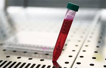 Тест на антитела к коронавирусу можно сделать в частных лабораториях по всей Беларуси - charter97.org - Белоруссия