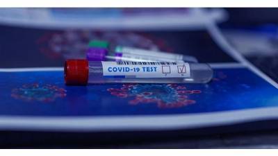 Простудные инфекции укрепляют иммунитет к COVID-19 - piter.tv